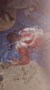 Horrible massacre au Yémen par la coalition arabo-US2